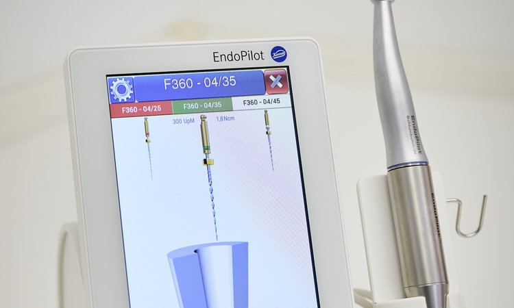 Endodontie: EndoPilot